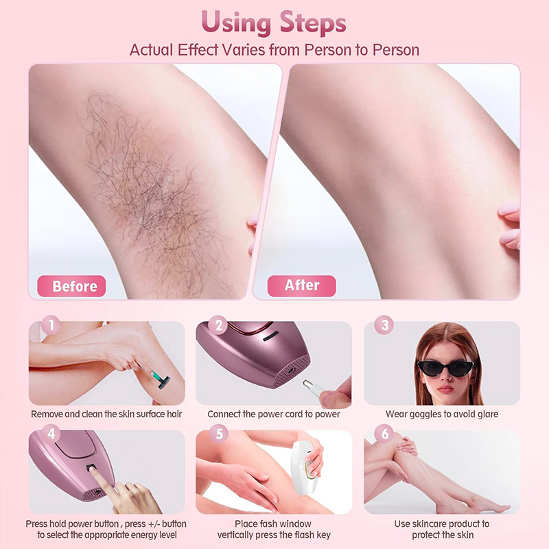 Removedor de pelos a laser ipl - Hair Care Or Haircare avaliação e preço